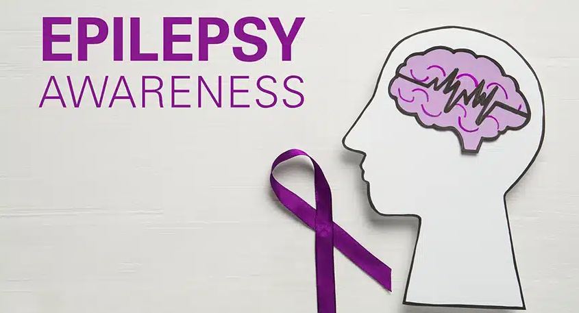 epilepsy treatment
